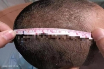 误会孙女被打爷爷重伤其同学获刑 嬉戏打闹引发悲剧