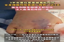 女童在家被眼镜王蛇咬伤后奇迹生还 生死边缘的三天较量