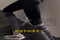 30岁女子爬楼瘦腿膝盖老成60岁 医生提醒：大腿粗小腿细才健康