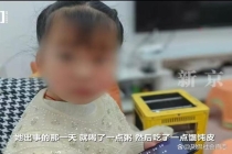女童手术出院后口鼻喷血死亡 家属质疑 基层医疗安全警钟