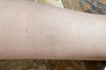 小区有人散养猪还追人拱人 物业回应 宠物猪引发惊吓