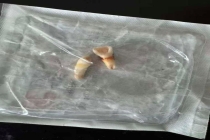 男孩遭母亲同居男友殴打致轻伤二级 施暴者已被刑拘