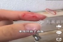 女子被加州王蛇咬住淡定冲水 八年宠物蛇无毒