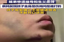 遭虐待男童反复说妈妈你能带我走吗 确认不会送回才敢诉苦