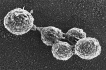 基因组移植让僵尸细胞死而复生 推动微生物生命设计