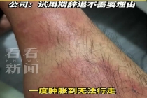 中国男子举报澳洲肉厂安全问题被辞 涉嫌报复性解雇