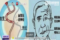眼皮一直跳警惕面肌痉挛！女子眼皮跳10年打5年肉毒没治好