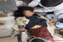 女子做医美微针次日突发晕厥 高敏体质引发争议
