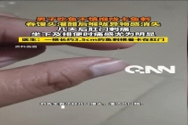 男子鱼刺卡喉硬吞4天后扎进肛门 错误处理酿成大祸