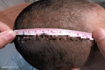 爷爷误会孙女被打砍伤其同学被判无期 校园误解引发悲剧