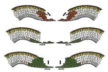伤口“晾干”好还是“保湿”好 湿性愈合更科学