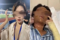 湖南永州女主播被炸伤案开庭 嫌疑人多次报复行为曝光