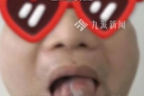 男子舌头长疙瘩以为上火结果是舌癌 小疙瘩竟是恶性肿瘤