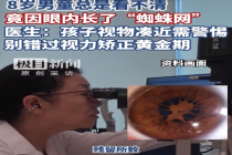 8岁男童眼内长蜘蛛网看不清 医生：孩子视物凑近需警惕，别错过视力矫正黄金期