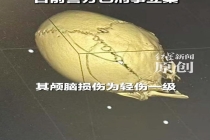 骂对方小孩没家教遭暴打男子发声 家长冲突致伤情严重
