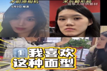 主刀医生回应女孩正颌变鞋拔子脸：我喜欢这种面型，现在的面型比之前更洋气